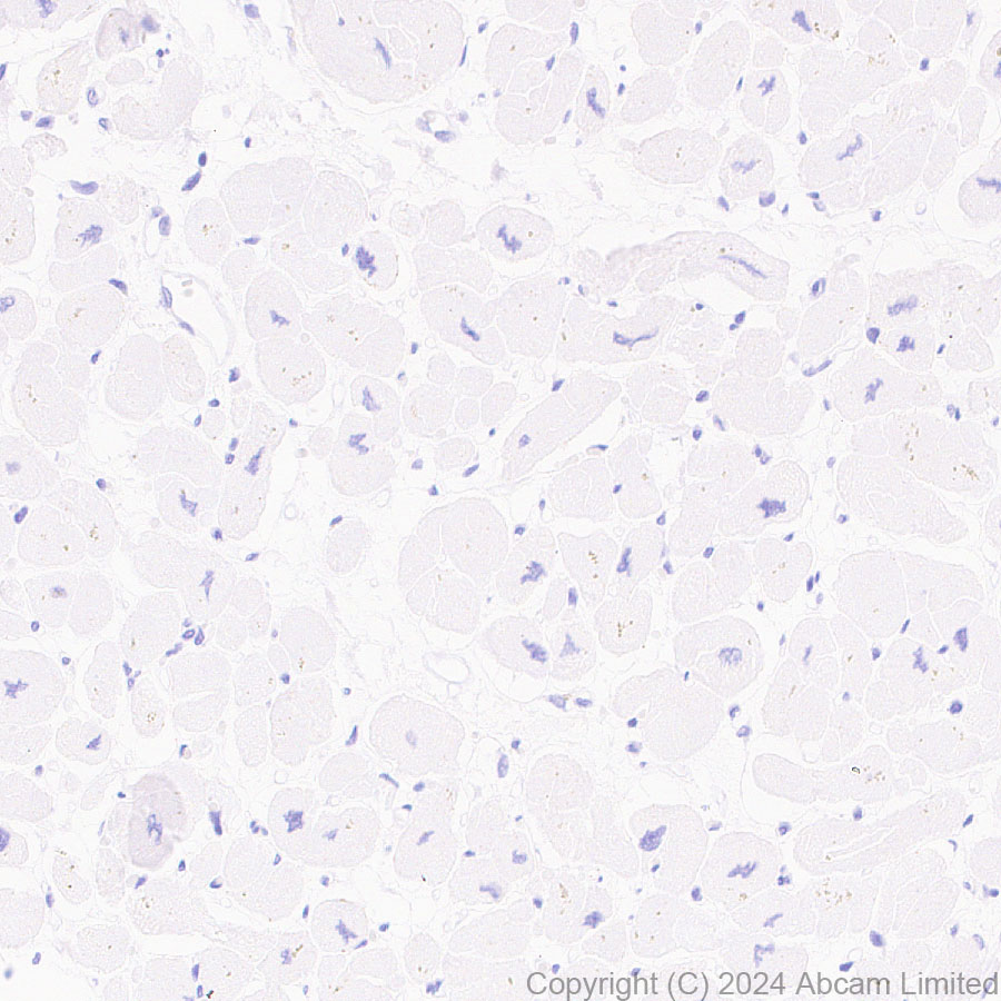 Immunohistochemistry (Formalin/PFA-fixed paraffin-embedded sections) - Anti-EBI3 antibody [RM2064] - BSA and Azide free (AB319169), expandable thumbnail