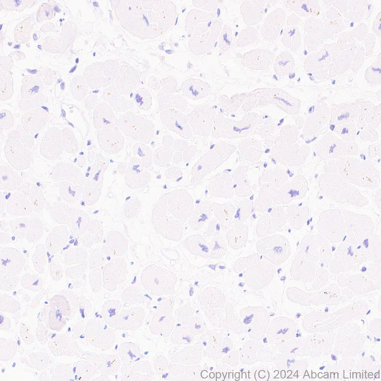 Immunohistochemistry (Formalin/PFA-fixed paraffin-embedded sections) - Anti-EBI3 antibody [RM2064] - BSA and Azide free (AB319169)
