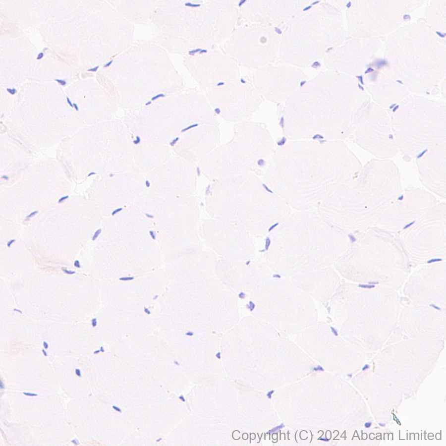 Immunohistochemistry (Formalin/PFA-fixed paraffin-embedded sections) - Anti-EBI3 antibody [RM2064] - BSA and Azide free (AB319169), expandable thumbnail