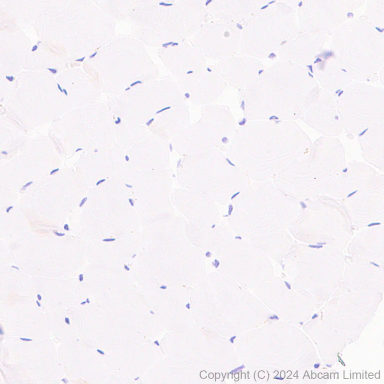 Immunohistochemistry (Formalin/PFA-fixed paraffin-embedded sections) - Anti-EBI3 antibody [RM2064] - BSA and Azide free (AB319169)