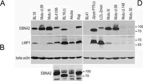 Western blot - Anti-EBNA2 antibody [PE2] (AB90543)