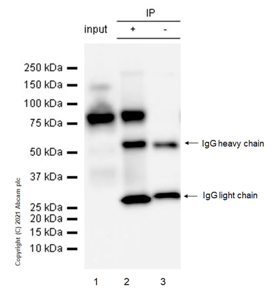 Immunoprecipitation - Anti-EBNA2 antibody [R3] (AB252828)