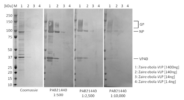 Western blot - Anti-Ebola virus antibody (AB243283), expandable thumbnail