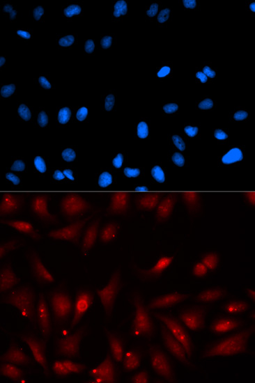 Immunocytochemistry/ Immunofluorescence - Anti-EBP1 antibody (AB186846), expandable thumbnail