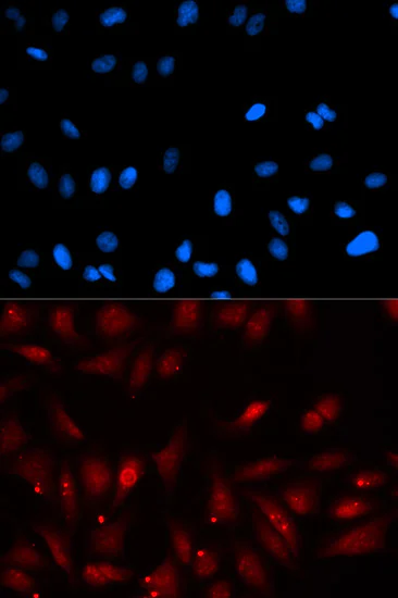 Immunocytochemistry/ Immunofluorescence - Anti-EBP1 antibody (AB186846)