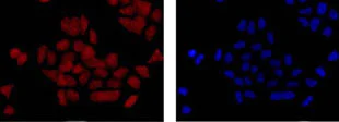 Immunocytochemistry/ Immunofluorescence - Anti-EBP1 antibody [EPR14569(B)] (AB180602)