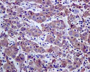 Immunohistochemistry (Formalin/PFA-fixed paraffin-embedded sections) - Anti-EBP1 antibody [EPR14569(B)] (AB180602)