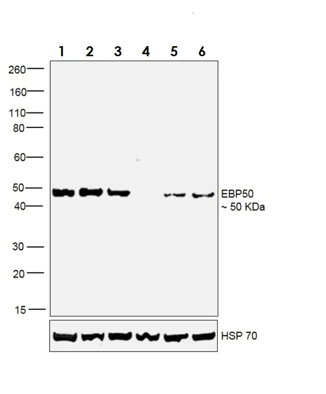 Western blot - Anti-EBP50/NHERF-1 antibody (AB3452)