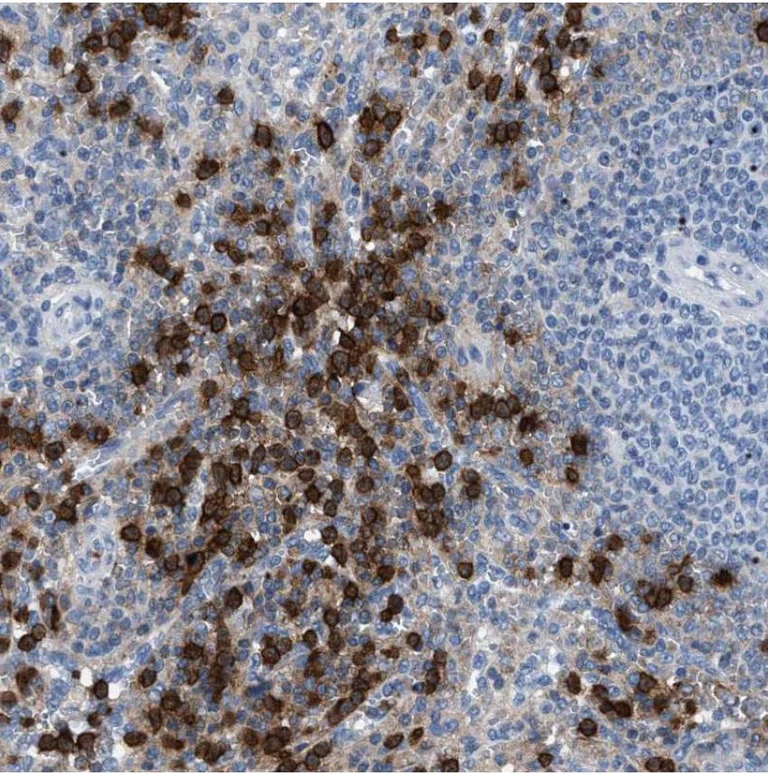Immunohistochemistry (Formalin/PFA-fixed paraffin-embedded sections) - Anti-EBS antibody - N-terminal (AB224439)