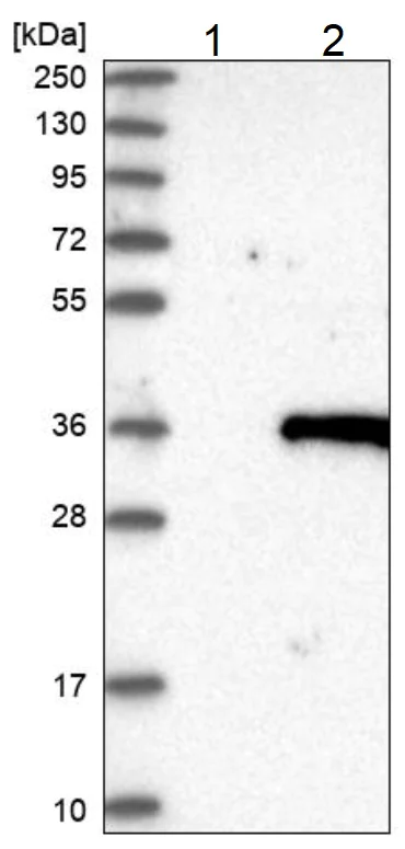 Western blot - Anti-EBS antibody - N-terminal (AB224439)