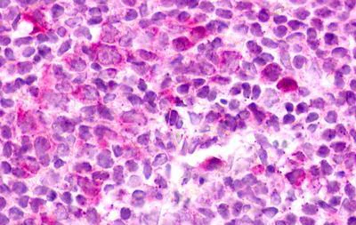 Immunohistochemistry (Formalin/PFA-fixed paraffin-embedded sections) - Anti-EBV Induced Gene 2/EBI2 antibody (AB150625)