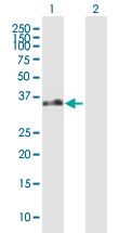 Western blot - Anti-EBV Induced Gene 2/EBI2 antibody (AB168744)