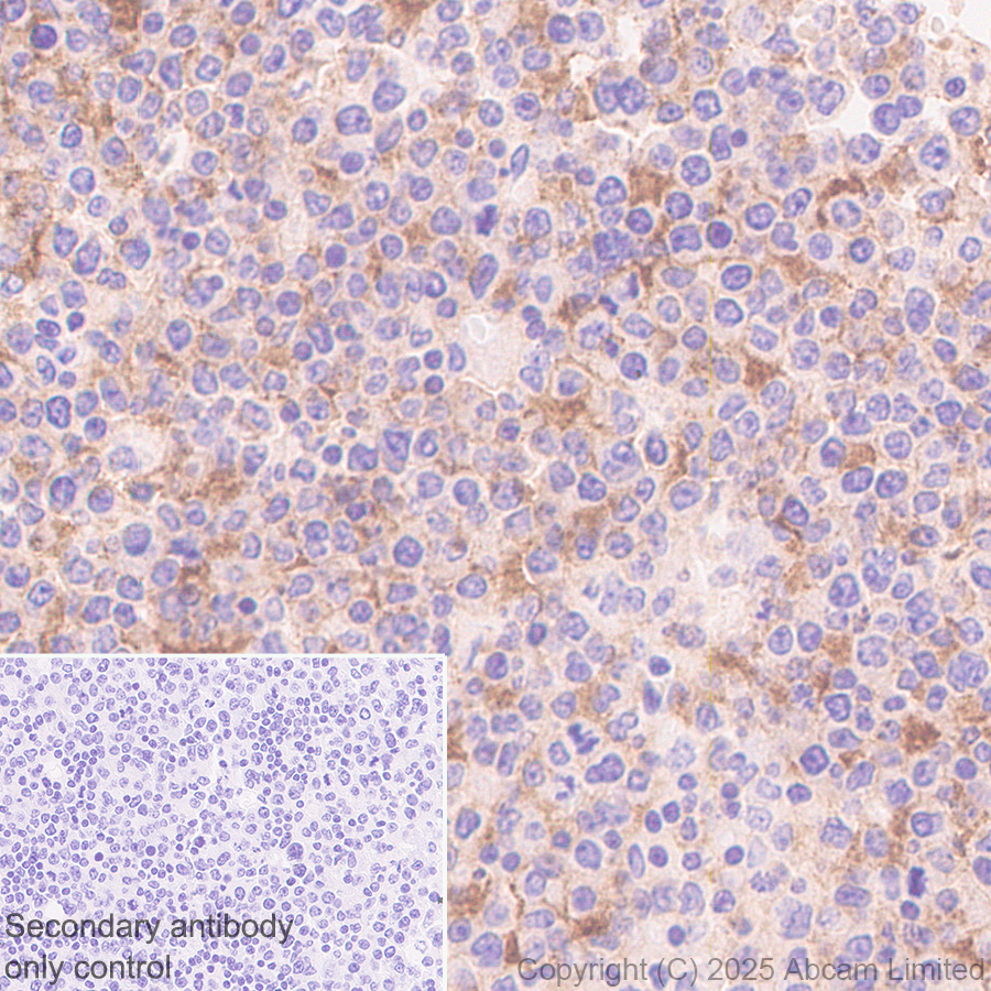 Immunohistochemistry (Formalin/PFA-fixed paraffin-embedded sections) - Anti-EBV Induced Gene 2/EBI2  antibody [EPR27339-565] (AB323862), expandable thumbnail