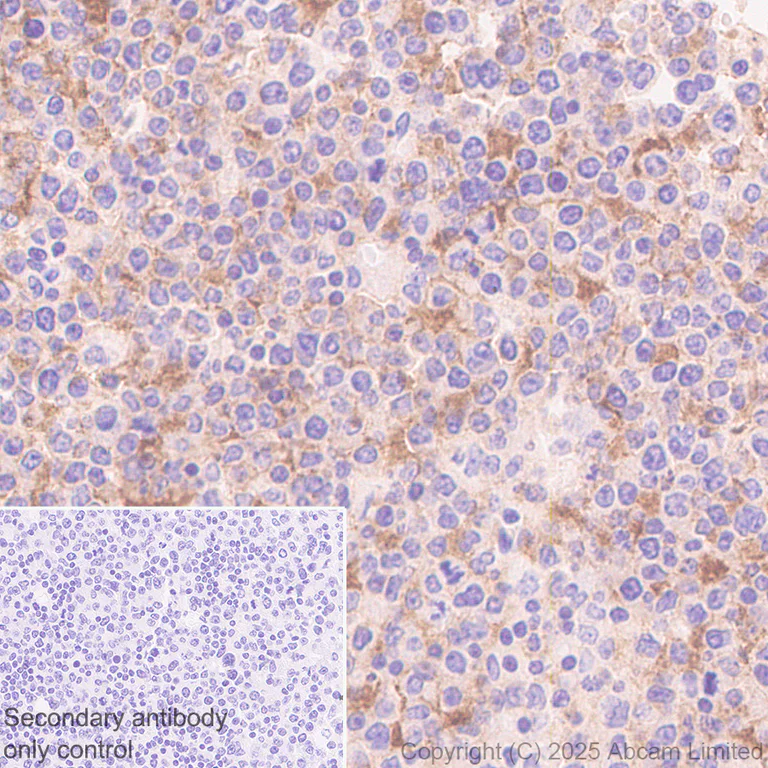 Immunohistochemistry (Formalin/PFA-fixed paraffin-embedded sections) - Anti-EBV Induced Gene 2/EBI2 antibody [EPR27339-565] (AB323862)