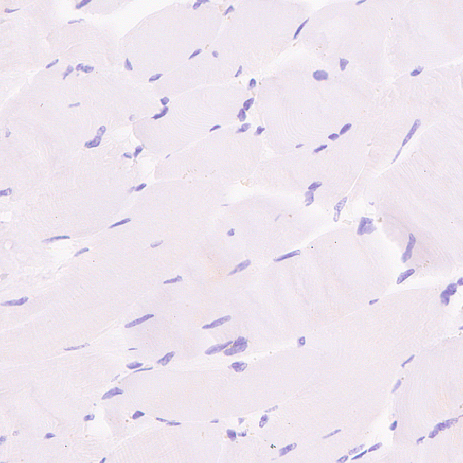Immunohistochemistry (Formalin/PFA-fixed paraffin-embedded sections) - Anti-EBV Induced Gene 2/EBI2  antibody [EPR27339-565] (AB323862), expandable thumbnail
