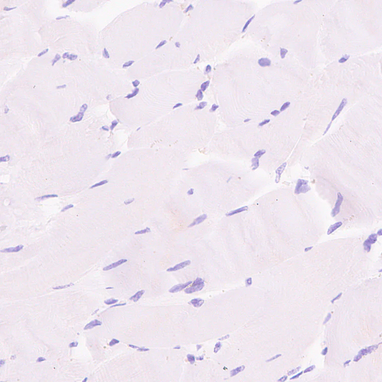 Immunohistochemistry (Formalin/PFA-fixed paraffin-embedded sections) - Anti-EBV Induced Gene 2/EBI2 antibody [EPR27339-565] (AB323862)
