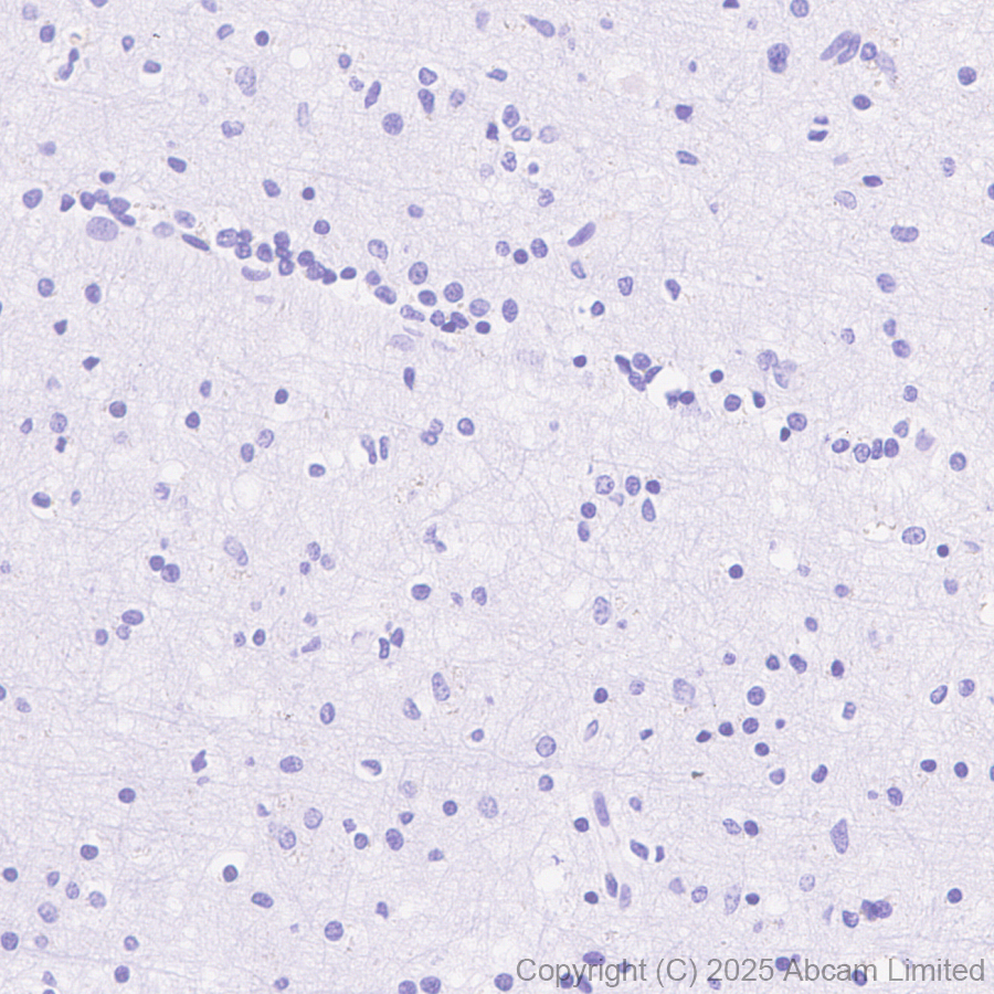 Immunohistochemistry (Formalin/PFA-fixed paraffin-embedded sections) - Anti-EBV Induced Gene 2/EBI2  antibody [EPR27339-565] (AB323862), expandable thumbnail