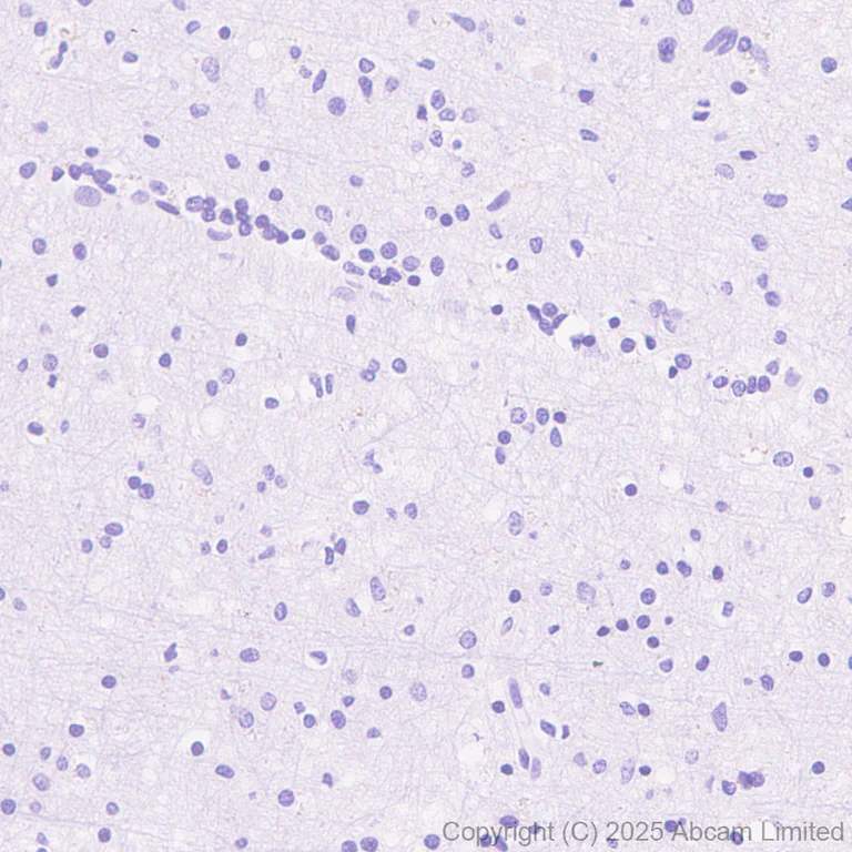 Immunohistochemistry (Formalin/PFA-fixed paraffin-embedded sections) - Anti-EBV Induced Gene 2/EBI2 antibody [EPR27339-565] (AB323862)