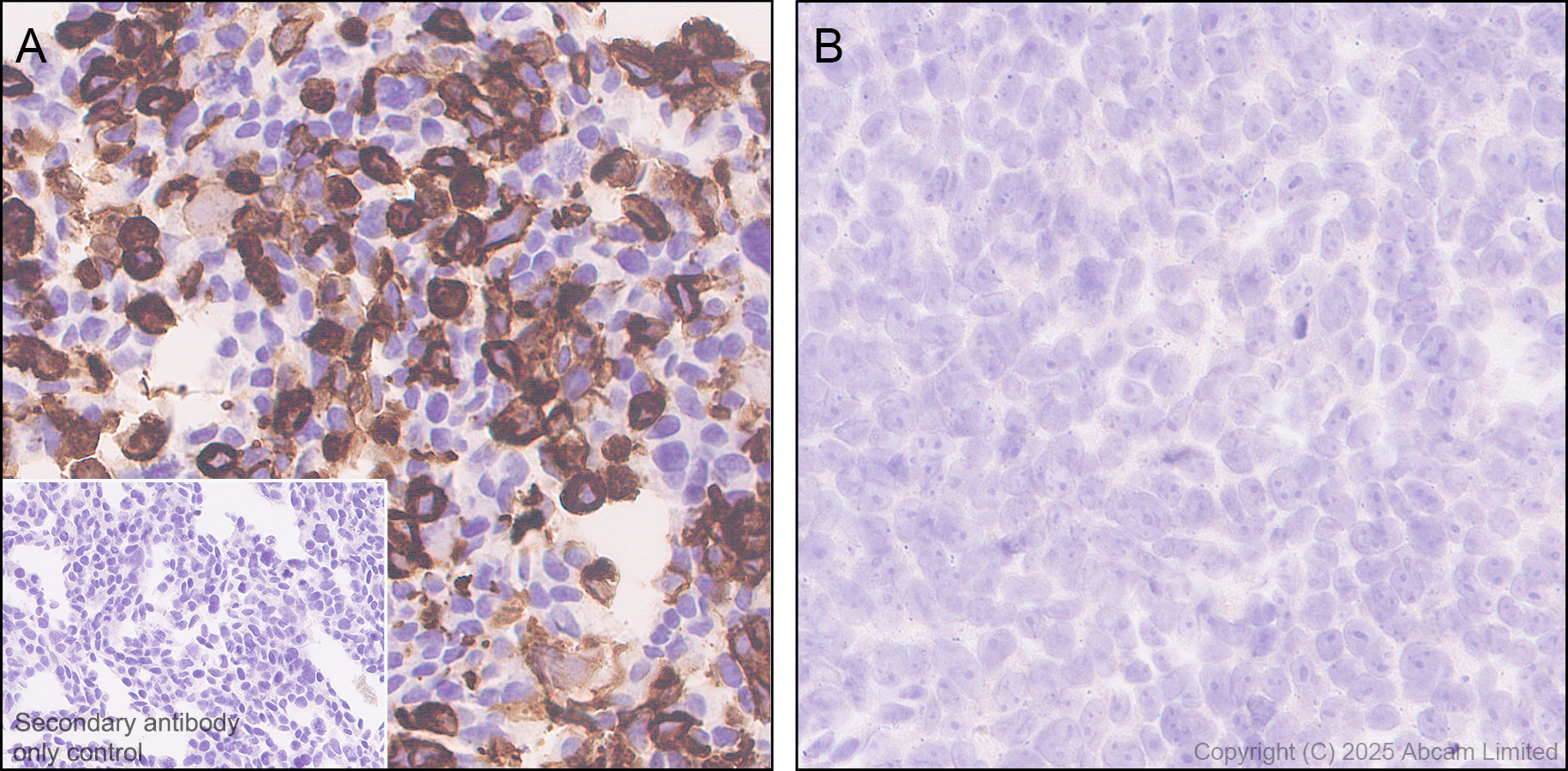 Immunohistochemistry (Formalin/PFA-fixed paraffin-embedded sections) - Anti-EBV Induced Gene 2/EBI2  antibody [EPR27339-565] (AB323862), expandable thumbnail