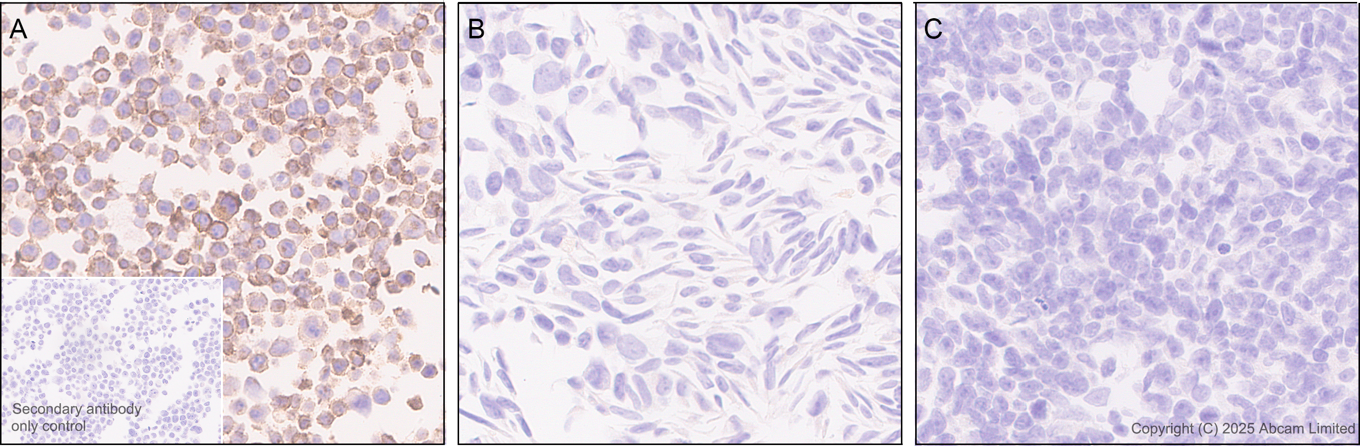 Immunohistochemistry (Formalin/PFA-fixed paraffin-embedded sections) - Anti-EBV Induced Gene 2/EBI2  antibody [EPR27339-565] (AB323862), expandable thumbnail