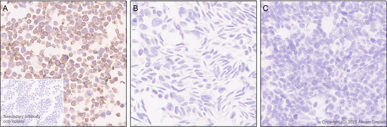 Immunohistochemistry (Formalin/PFA-fixed paraffin-embedded sections) - Anti-EBV Induced Gene 2/EBI2 antibody [EPR27339-565] (AB323862)