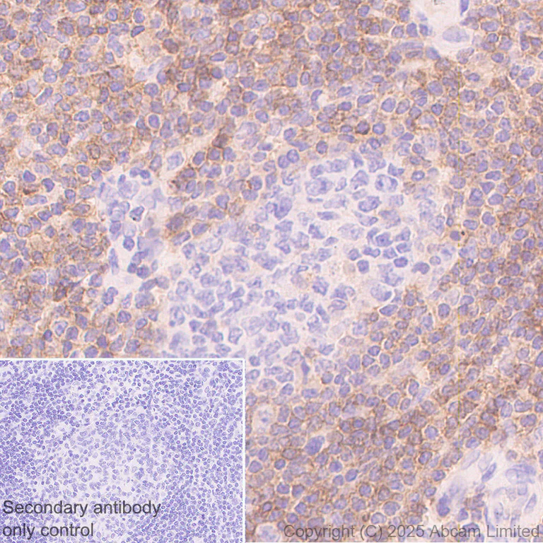 Immunohistochemistry (Formalin/PFA-fixed paraffin-embedded sections) - Anti-EBV Induced Gene 2/EBI2 antibody [EPR27339-565] - BSA and Azide free (AB326590)
