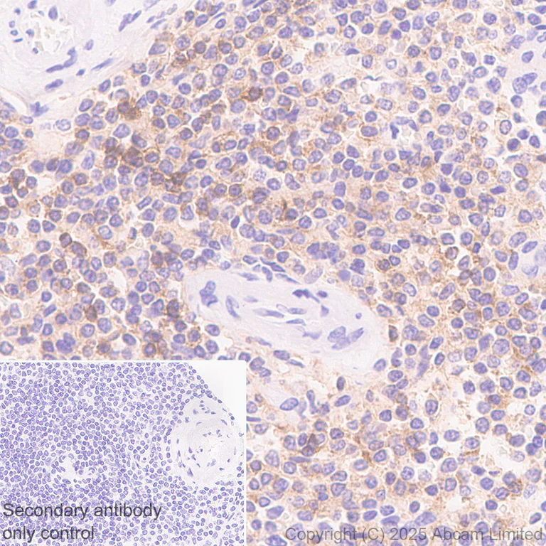 Immunohistochemistry (Formalin/PFA-fixed paraffin-embedded sections) - Anti-EBV Induced Gene 2/EBI2 antibody [EPR27339-565] - BSA and Azide free (AB326590)