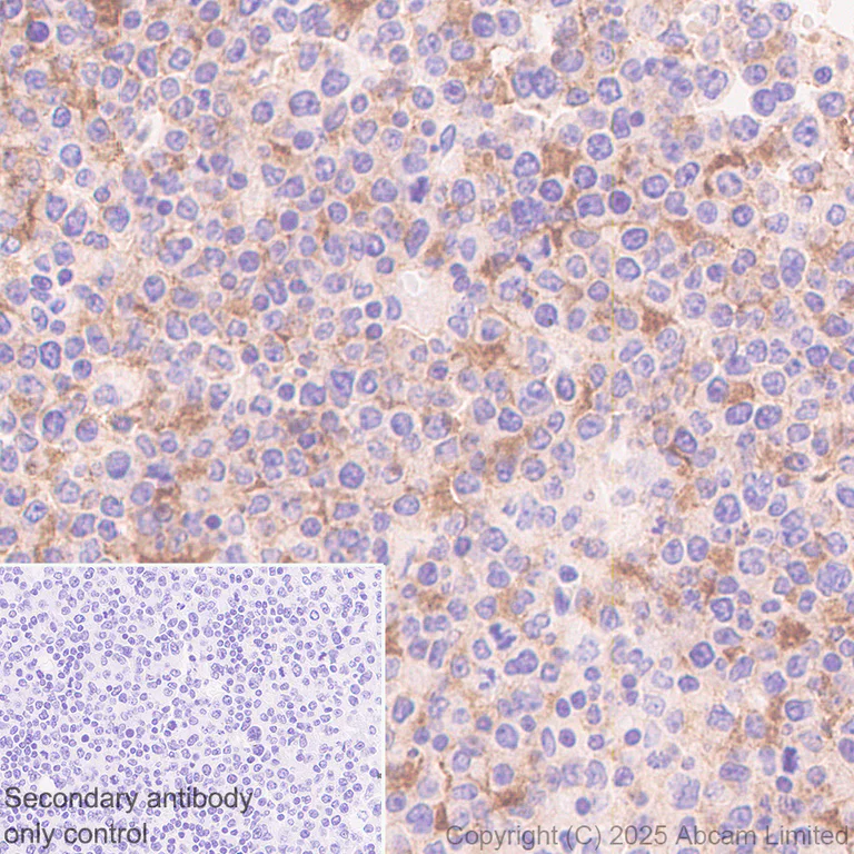 Immunohistochemistry (Formalin/PFA-fixed paraffin-embedded sections) - Anti-EBV Induced Gene 2/EBI2 antibody [EPR27339-565] - BSA and Azide free (AB326590)