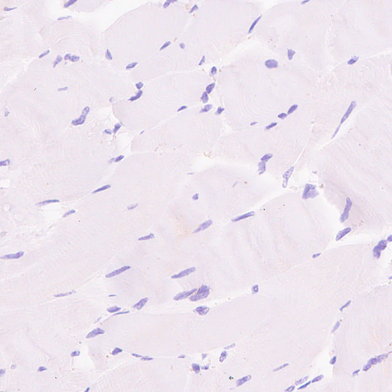 Immunohistochemistry (Formalin/PFA-fixed paraffin-embedded sections) - Anti-EBV Induced Gene 2/EBI2 antibody [EPR27339-565] - BSA and Azide free (AB326590)