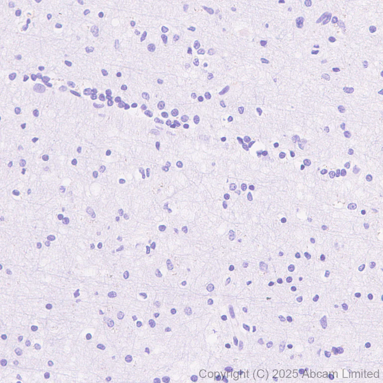 Immunohistochemistry (Formalin/PFA-fixed paraffin-embedded sections) - Anti-EBV Induced Gene 2/EBI2 antibody [EPR27339-565] - BSA and Azide free (AB326590)