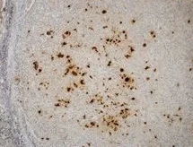 Immunohistochemistry (Formalin/PFA-fixed paraffin-embedded sections) - Anti-EBV Latent Membrane Protein 1 antibody [D24-G] (AB136633)