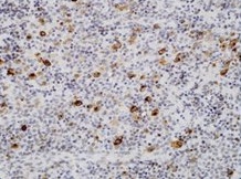Immunohistochemistry (Formalin/PFA-fixed paraffin-embedded sections) - Anti-EBV Latent Membrane Protein 1 antibody [D24-G] (AB136633)