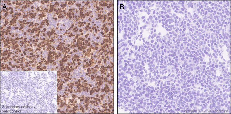 Immunohistochemistry (Formalin/PFA-fixed paraffin-embedded sections) - Anti-EBV Nuclear Antigen/EBNA1 antibody [EPR28706-78] (AB316860)