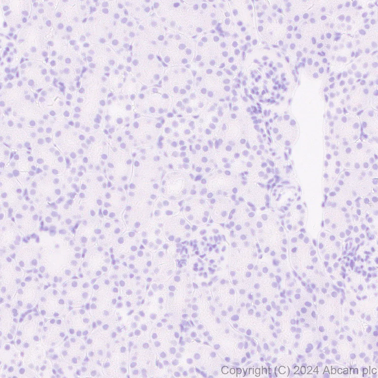 Immunohistochemistry (Formalin/PFA-fixed paraffin-embedded sections) - Anti-EBV Nuclear Antigen/EBNA1 antibody [EPR28706-78] (AB316860)