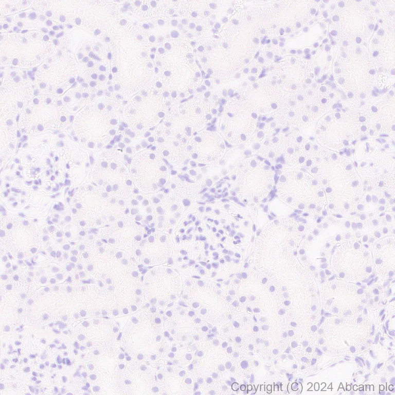 Immunohistochemistry (Formalin/PFA-fixed paraffin-embedded sections) - Anti-EBV Nuclear Antigen/EBNA1 antibody [EPR28706-78] (AB316860)