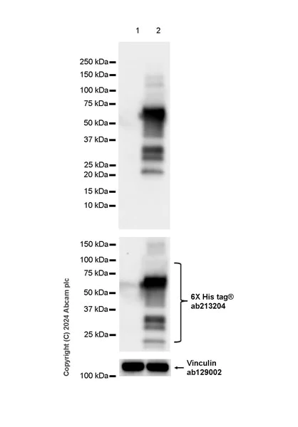 Western blot - Anti-EBV Nuclear Antigen/EBNA1 antibody [EPR28706-78] - BSA and Azide free (AB316861)