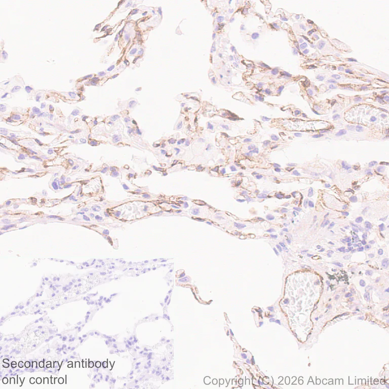 Immunohistochemistry (Formalin/PFA-fixed paraffin-embedded sections) - Anti-ECE1 antibody [EPR30300-555] (AB326103)