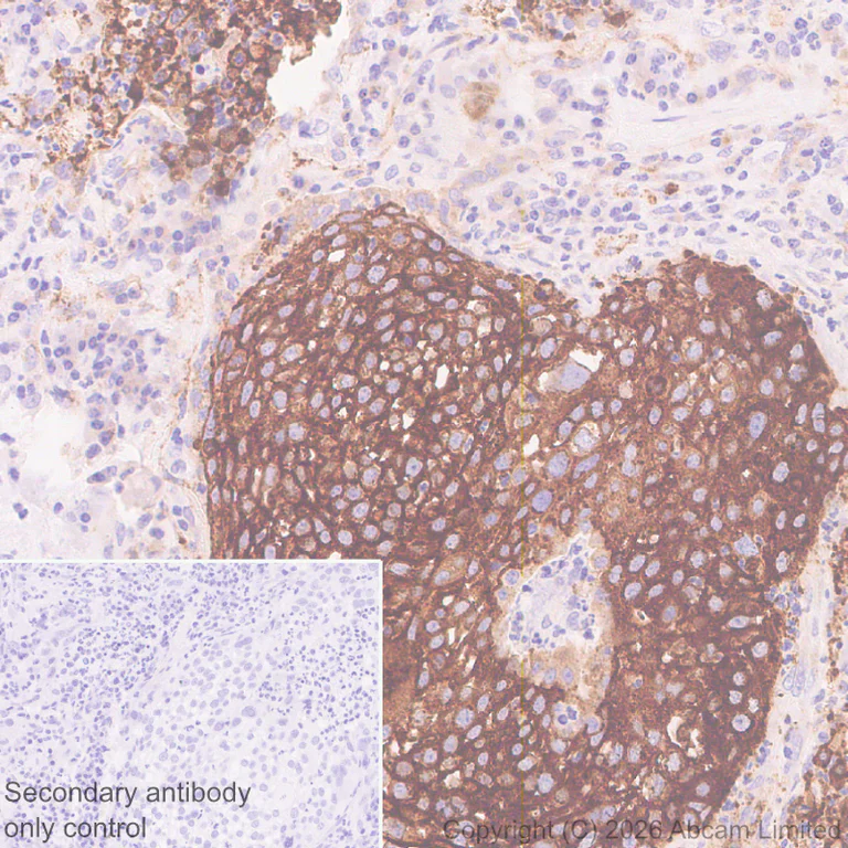 Immunohistochemistry (Formalin/PFA-fixed paraffin-embedded sections) - Anti-ECE1 antibody [EPR30300-555] (AB326103)