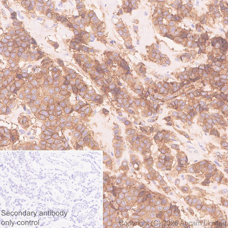Immunohistochemistry (Formalin/PFA-fixed paraffin-embedded sections) - Anti-ECE1 antibody [EPR30300-555] (AB326103)