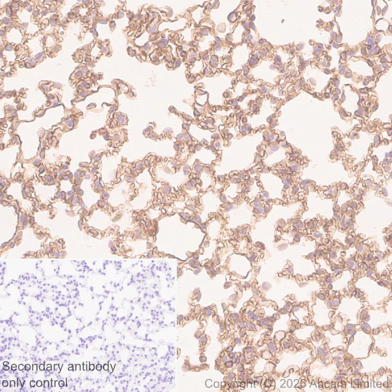 Immunohistochemistry (Formalin/PFA-fixed paraffin-embedded sections) - Anti-ECE1 antibody [EPR30300-555] (AB326103)