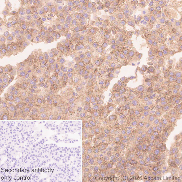Immunohistochemistry (Formalin/PFA-fixed paraffin-embedded sections) - Anti-ECE1 antibody [EPR30300-555] (AB326103)