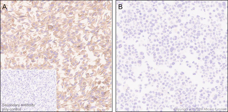 Immunohistochemistry (Formalin/PFA-fixed paraffin-embedded sections) - Anti-ECE1 antibody [EPR30300-555] (AB326103)