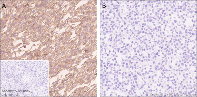 Immunohistochemistry (Formalin/PFA-fixed paraffin-embedded sections) - Anti-ECE1 antibody [EPR30300-555] (AB326103)