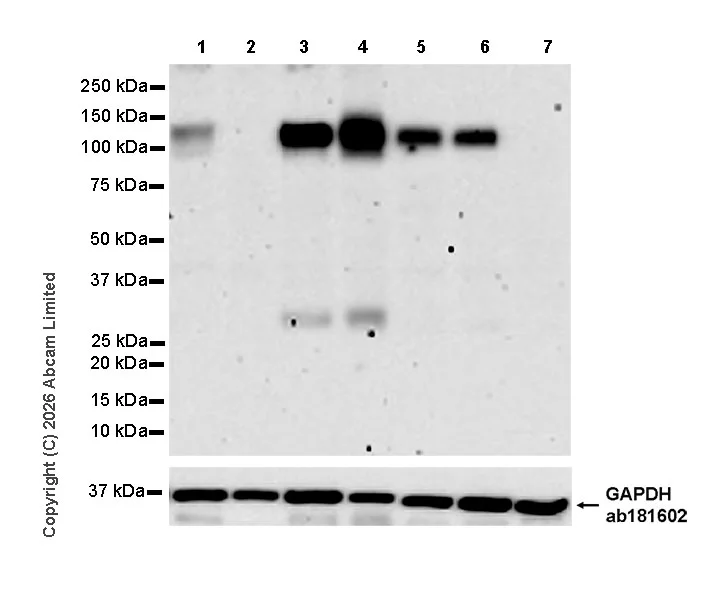 Western blot - Anti-ECE1 antibody [EPR30300-555] (AB326103)