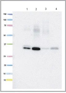 Western blot - Anti-ECH1 antibody [3B7CF2AC8] (AB123450)