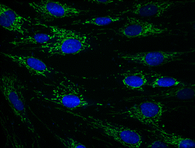 Immunocytochemistry/ Immunofluorescence - Anti-ECH1 antibody [9D11AF3] (AB110294)