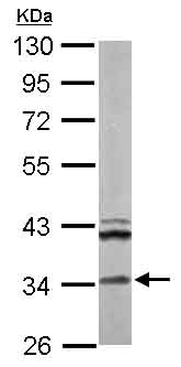 Western blot - Anti-ECH1 antibody (AB153720), expandable thumbnail