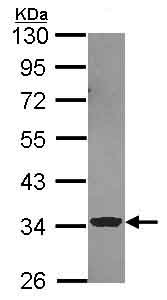 Western blot - Anti-ECH1 antibody (AB153720), expandable thumbnail