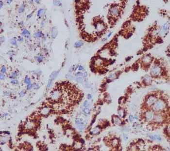 Immunohistochemistry (Formalin/PFA-fixed paraffin-embedded sections) - Anti-ECH1 antibody [EPR15449(B)] - C-terminal (AB189255)
