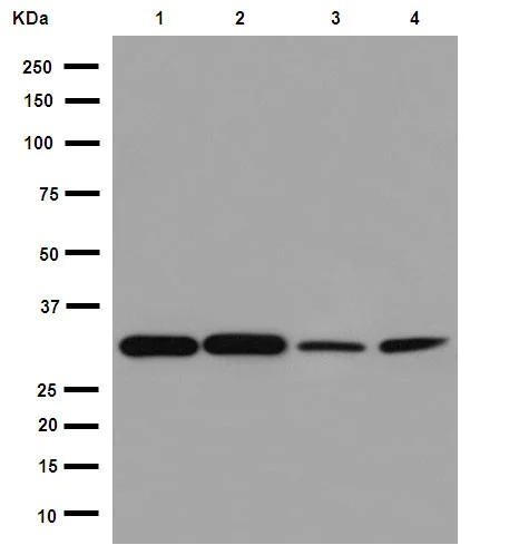 Western blot - Anti-ECH1 antibody [EPR15449(B)] - C-terminal (AB189255)